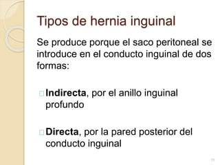 Tipos de hernia inguinal
Se produce porque el saco peritoneal se
introduce en el conducto inguinal de dos
formas:
Indirecta, por el anillo inguinal
profundo
Directa, por la pared posterior del
conducto inguinal
11
 