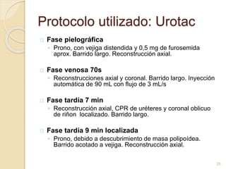 Protocolo utilizado: Urotac
Fase pielográfica
◦ Prono, con vejiga distendida y 0,5 mg de furosemida
aprox. Barrido largo. Reconstrucción axial.
Fase venosa 70s
◦ Reconstrucciones axial y coronal. Barrido largo. Inyección
automática de 90 mL con flujo de 3 mL/s
Fase tardía 7 min
◦ Reconstrucción axial, CPR de uréteres y coronal oblicuo
de riñon localizado. Barrido largo.
Fase tardía 9 min localizada
◦ Prono, debido a descubrimiento de masa polipoídea.
Barrido acotado a vejiga. Reconstrucción axial.
25
 