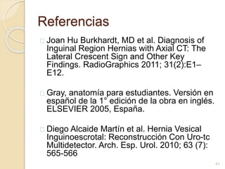 Referencias
Joan Hu Burkhardt, MD et al. Diagnosis of
Inguinal Region Hernias with Axial CT: The
Lateral Crescent Sign and Other Key
Findings. RadioGraphics 2011; 31(2):E1–
E12.
Gray, anatomía para estudiantes. Versión en
español de la 1° edición de la obra en inglés.
ELSEVIER 2005, España.
Diego Alcaide Martín et al. Hernia Vesical
Inguinoescrotal: Reconstrucción Con Uro-tc
Multidetector. Arch. Esp. Urol. 2010; 63 (7):
565-566
41
 