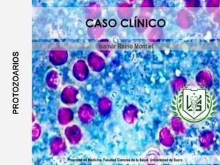 CASO CLÍNICO
Isamar Reino Montiel
Programa de Medicina. Facultad Ciencias de la Salud. Universidad de Sucre.
 
