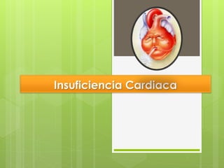 Insuficiencia Cardiaca
 