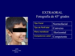 caso_clinico_J[1].ppt