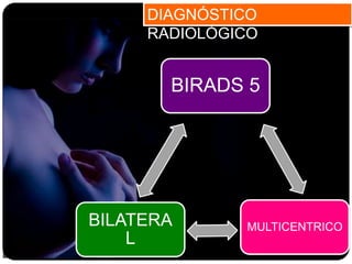 DIAGNÓSTICO
RADIOLÓGICO
BIRADS 5
MULTICENTRICOBILATERA
L
 