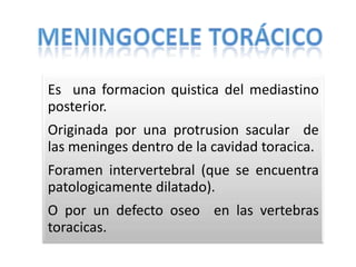 Caso clinico meningocele toracico definitivo