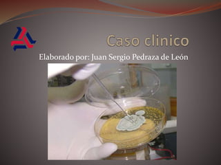 Caso clinico Elaborado por: Juan Sergio Pedraza de León 