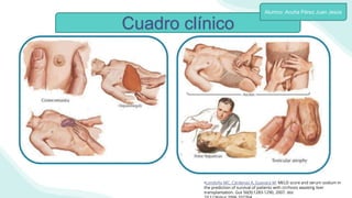 Cuadro clínico
Alumno: Acuña Pérez Juan Jesús
•Londoño MC, Cárdenas A, Guevara M: MELD score and serum sodium in
the prediction of survival of patients with cirrhosis awaiting liver
transplantation. Gut 56(9):1283-1290, 2007. doi:
 