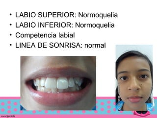 caso clinico niña | PPT