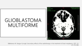 GLIOBLASTOMA
MULTIFORME
Ballesteros M, Vargas-Carvajal. Secondary effects of the radiotherapy in the treatment of brain neoplasms. 2017. 35
(7); 313-366
 