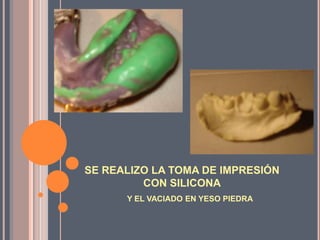 SE REALIZO LA TOMA DE IMPRESIÓN
         CON SILICONA
      Y EL VACIADO EN YESO PIEDRA
 