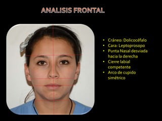 Caso clinico ortodoncia Valeria Fernandez
