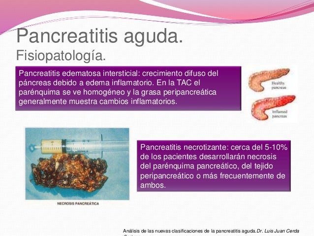 Caso Clinico De Pancreatitis Aguda En Adultos es.slideshare.net