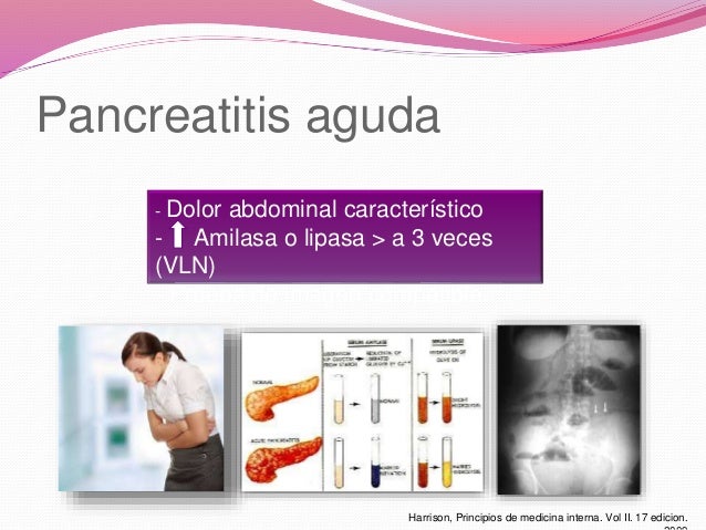 Caso Clinico De Pancreatitis Aguda En Adultos es.slideshare.net