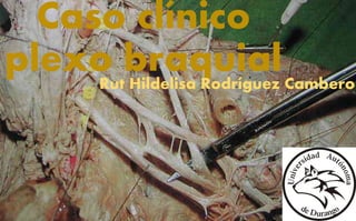 Caso clínico
plexo braquial
Rut Hildelisa Rodríguez Cambero
 