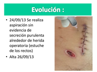 • 24/09/13 Se realiza
aspiración sin
evidencia de
secreción purulenta
alrededor de herida
operatoria (estuche
de los rectos)
• Alta 26/09/13
 