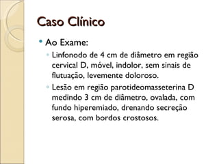 Plect Caso clinico plect | PPT