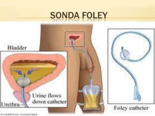 SONDA FOLEY