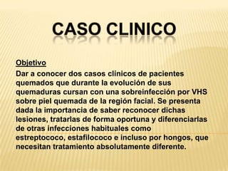 CASO CLINICOObjetivoDar a conocer dos casos clínicos de pacientes quemados que durante la evolución de sus quemaduras cursan con una sobreinfección por VHS sobre piel quemada de la región facial. Se presenta dada la importancia de saber reconocer dichas lesiones, tratarlas de forma oportuna y diferenciarlas de otras infecciones habituales como estreptococo, estafilococo e incluso por hongos, que necesitan tratamiento absolutamente diferente.