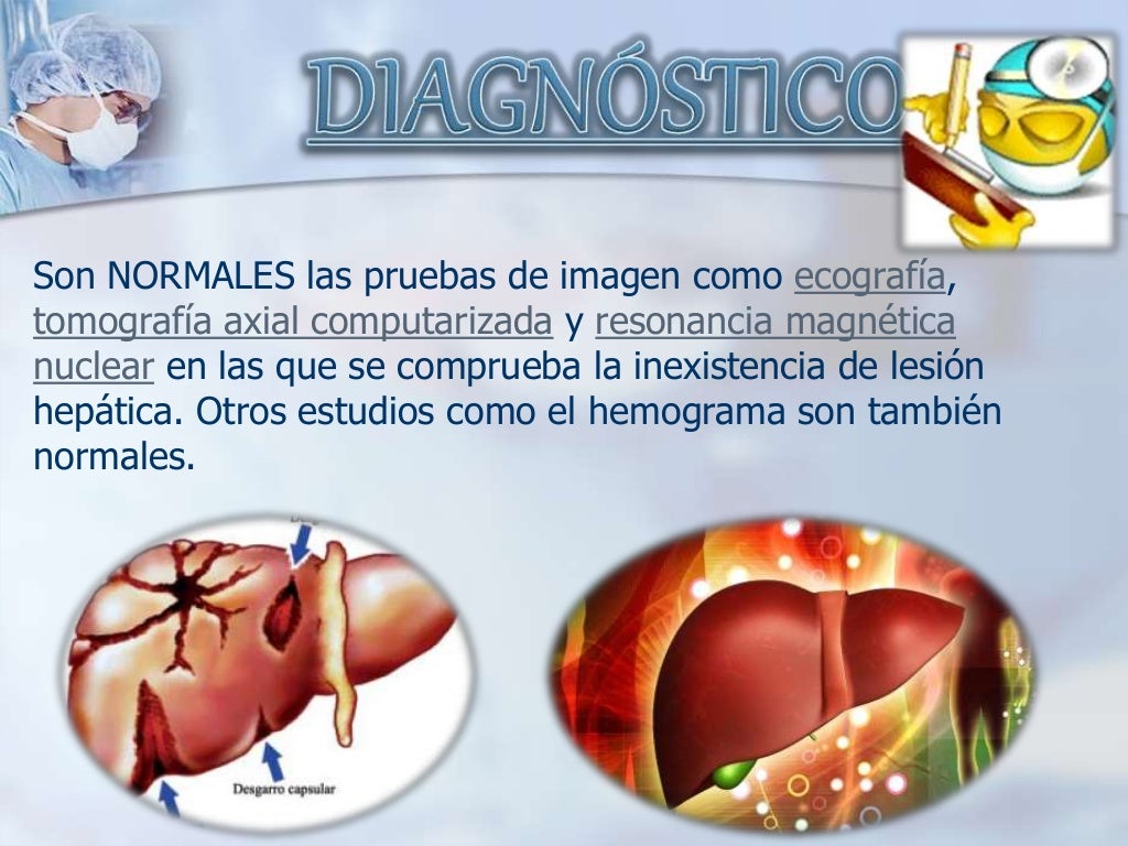 Caso clinico sindrome gilbert