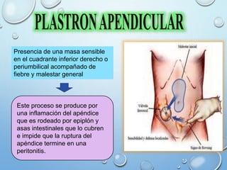 Presencia de una masa sensible
en el cuadrante inferior derecho o
periumbilical acompañado de
fiebre y malestar general
Este proceso se produce por
una inflamación del apéndice
que es rodeado por epiplón y
asas intestinales que lo cubren
e impide que la ruptura del
apéndice termine en una
peritonitis.
 