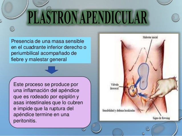PLASTRON APENDICULAR - PAE