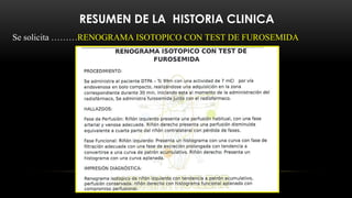 RESUMEN DE LA HISTORIA CLINICA
Se solicita ………RENOGRAMA ISOTOPICO CON TEST DE FUROSEMIDA
 