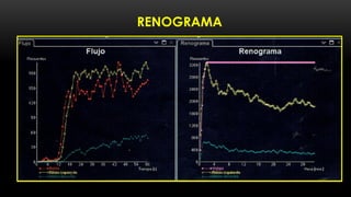 RENOGRAMA
 