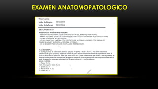 EXAMEN ANATOMOPATOLOGICO
 