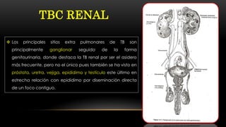 TBC RENAL
 Los principales sitios extra pulmonares de TB son
principalmente ganglionar seguido de la forma
genitourinaria, donde destaca la TB renal por ser el asidero
más frecuente, pero no el único pues también se ha visto en
próstata, uretra, vejiga, epidídimo y testículo este último en
estrecha relación con epidídimo por diseminación directa
de un foco contiguo.
 