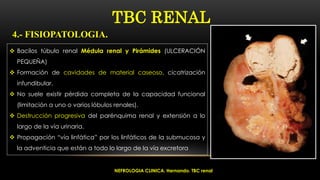  Bacilos túbulo renal Médula renal y Pirámides (ULCERACIÓN
PEQUEÑA)
 Formación de cavidades de material caseoso, cicatrización
infundibular.
 No suele existir pérdida completa de la capacidad funcional
(limitación a uno o varios lóbulos renales).
 Destrucción progresiva del parénquima renal y extensión a lo
largo de la vía urinaria.
 Propagación “vía linfática” por los linfáticos de la submucosa y
la adventicia que están a todo lo largo de la vía excretora
TBC RENAL
4.- FISIOPATOLOGIA.
NEFROLOGIA CLINICA. Hernando. TBC renal
 
