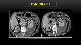TOMOGRAFIA
 