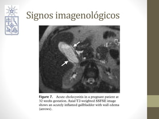 Signos imagenológicos
 