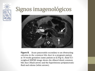 Signos imagenológicos
 