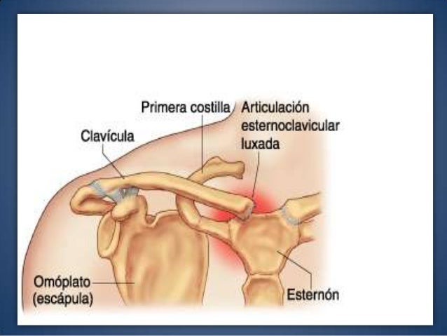 Caso clinico "Luxación de hombro" traumatologia!!!