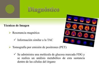 Técnicas de Imagen

    Resonancia magnética

       Información similar a la TAC

    Tomografía por emisión de positrones (PET)

       Se administra una molécula de glucosa marcada FDG y
        se realiza un análisis metabólico de esta sustancia
        dentro de las células del órgano
 