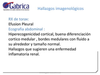RX de torax:
Efusion Pleural
Ecografia abdominal :
Hiperecogenicidad cortical, buena diferenciación
cortico medular , bordes medulares con fluido a
su alrededor y tamaño normal.
Hallazgos que sugieren una enfermedad
inflamatoria renal.
Hallazgos imagenológicos
 