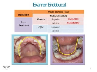 ExamenEndobucal
Dentición
Mixta primera fase
NORMOCLUSION
Arco
Dentario
Forma
Tipo
Superior OVALADO
Inferior CUADRADO
Superior -------------
Inferior ---------------
HC Nº : 29989
R. E .M .G
8a 2m 10
 