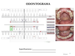 ODONTOGRAMA
12
Dr. Juver
Especificaciones :_________________________
_______________________________________
 