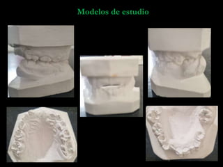 22
Modelos de estudio
 