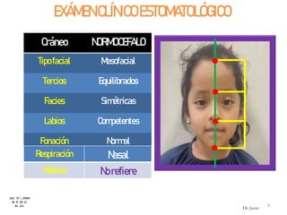 EXÁMEN CLÍNICOESTOMATOLÓGICO
Cráneo NORMOCEFALO
Tipofacial Mesofacial
Tercios Equilibrados
Facies Simétricas
Labios Competentes
Fonación Normal
Deglución Típica
Respiración Nasal
Hábitos Norefiere
HC Nº : 29989
R. E .M .G
8a 2m 6
Dr. Juver
 