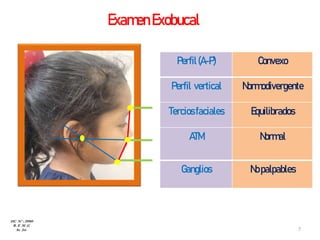 ExamenExobucal
Perfil(A-P) Convexo
Perfil vertical Normodivergente
Terciosfaciales Equilibrados
ATM Normal
Ganglios No palpables
HC Nº : 29989
R. E .M .G
8a 2m 7
 