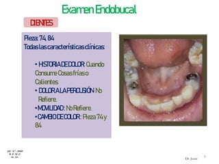 DIENTES
Pieza:74,84
Todaslascaracterísticasclínicas:
•HISTORIADEDOLOR: Cuando
ConsumeCosasfríaso
Calientes.
•DOLORALAPERCUSIÓN: No
Refiere.
•MOVILIDAD:NoRefiere.
•CAMBIODECOLOR:Pieza74y
84
ExamenEndobucal
HC Nº : 29989
R. E .M .G
8a 2m
Dr. Juver
9
Dr. Juver
 