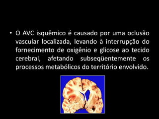 • O AVC isquêmico é causado por uma oclusão
  vascular localizada, levando à interrupção do
  fornecimento de oxigênio e glicose ao tecido
  cerebral, afetando subseqüentemente os
  processos metabólicos do território envolvido.
 