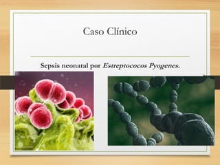 Caso Clínico


Sepsis neonatal por Estreptococos Pyogenes.
 