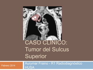 CASO CLÍNICO:
Tumor del Sulcus
Superior
Febrero 2014

Aurymar Fraino - R1 Radiodiagnóstico
HUSA

 