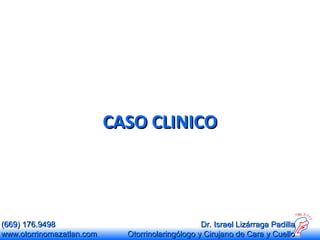 CASO CLINICO

(669) 176.9498
www.otorrinomazatlan.com

Dr. Israel Lizárraga Padilla
Otorrinolaringólogo y Cirujano de Cara y Cuello

 