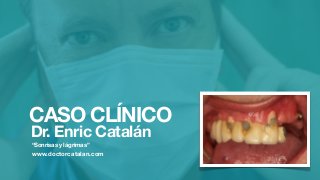 CASO CLÍNICO
Dr. Enric Catalán
“Sonrisas y lágrimas”
www.doctorcatalan.com
 