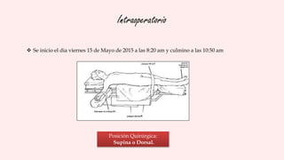 Intraoperatorio
 Se inicio el dia viernes 15 de Mayo de 2015 a las 8:20 am y culmino a las 10:50 am
Posición Quirúrgica:
Supina o Dorsal.
 