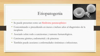 Criterios diagnósticos de Olivé (1997)
• Edad superior a 50 años.
• Poliartritis aguda.
• Edema con fóvea en ambas manos.
...