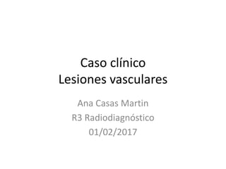 Caso clínico
Lesiones vasculares
Ana Casas Martin
R3 Radiodiagnóstico
01/02/2017
 