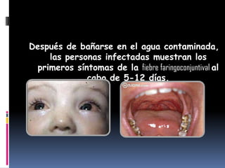 Después de bañarse en el agua contaminada,
las personas infectadas muestran los
primeros síntomas de la fiebre faringoconjuntival al
cabo de 5-12 días.
 
